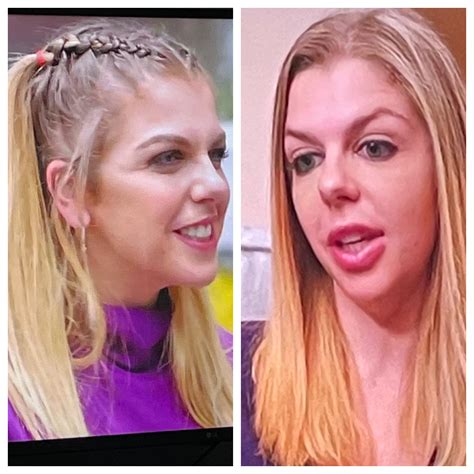 Whoa!! What’s going on with her face 🤨 it looks terrible : r/90DayFiance