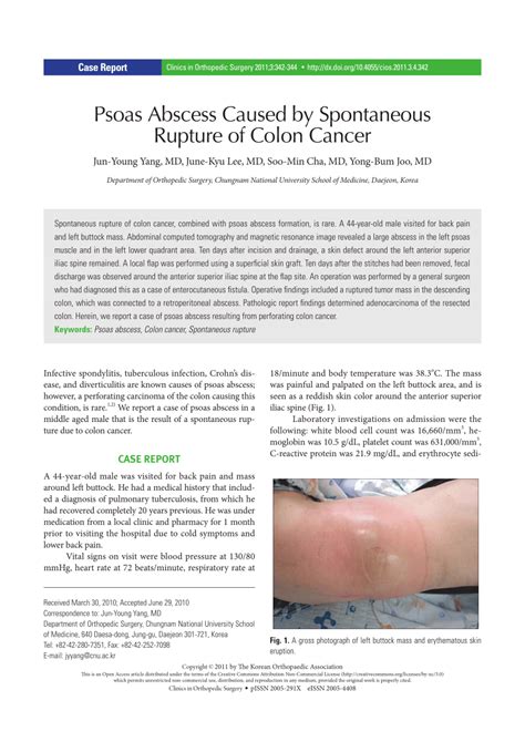 Pdf Psoas Abscess Caused By Spontaneous Rupture Of Colon Cancer