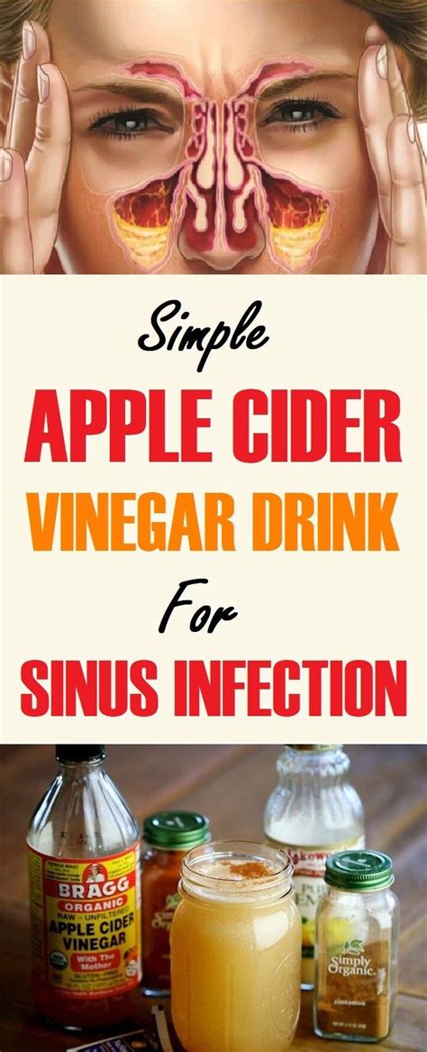 How To Use Apple Cider Vinegar To Treat Sinus Infections Apple Cider