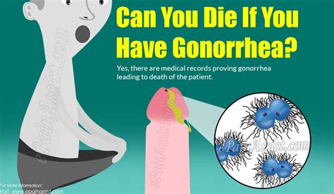 In a few people, infection spreads through the bloodstream to other parts it occurs mainly in women. Can You Die If You Have Gonorrhea?