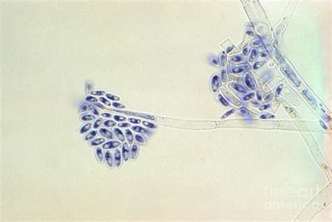 Acremonium Falciforme Lm Photograph By Science Source