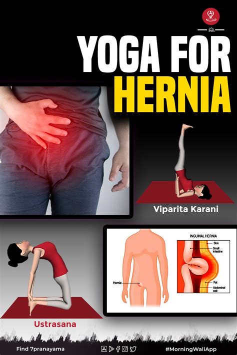 6 effective yoga poses for inguinal hernia artofit