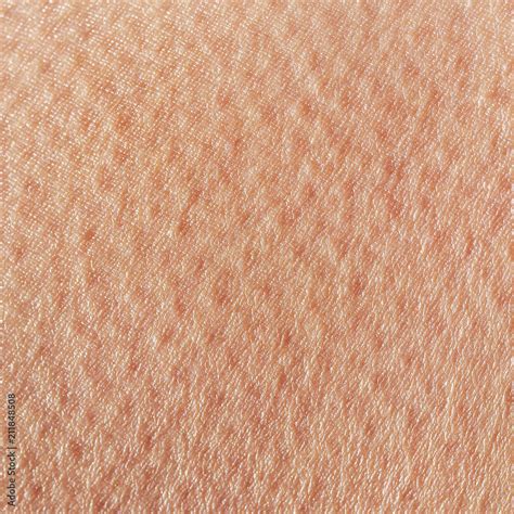 Skin Pore Texture