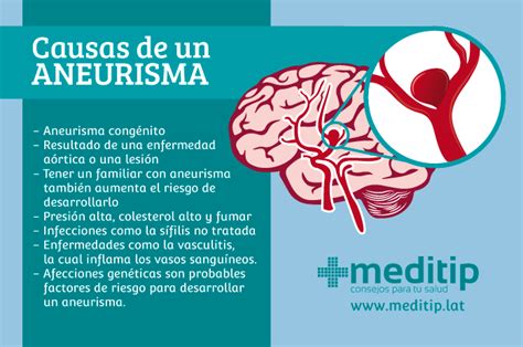 Aneurisma Tipos Causas Y Tratamiento Meditip