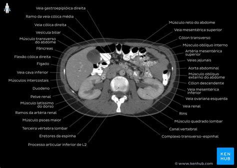 Use the mouse scroll wheel to move the images up and down alternatively use the tiny arrows (>>) on both side of the image to move the images. Imaginologia e anatomia radiológica: Raios x, TC, RM | Kenhub
