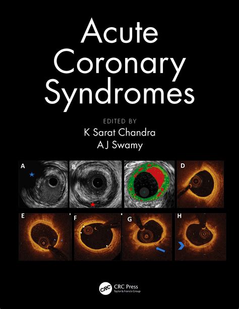 Acute Coronary Syndromes 9780367112226 Chandra K — Swamy A Axones