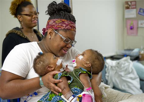 conjoined twins a zhari and a zhiah jones separated in rare phased surgery photos video