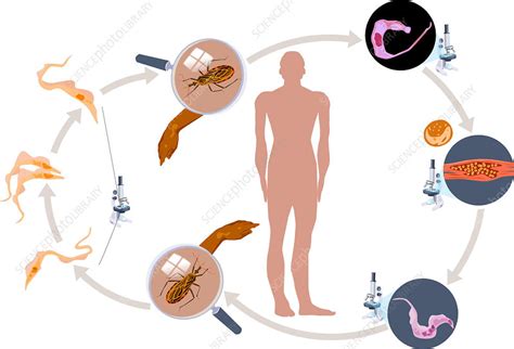 Chagas Disease Life Cycle Of The Parasite Human Stages Hot Sex Picture