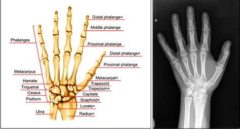 Skeletal Anatomy 4 And An X Ray Image Of A Hand 5 Download