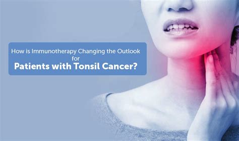 How Is Immunotherapy Changing The Outlook For Patients With Tonsil