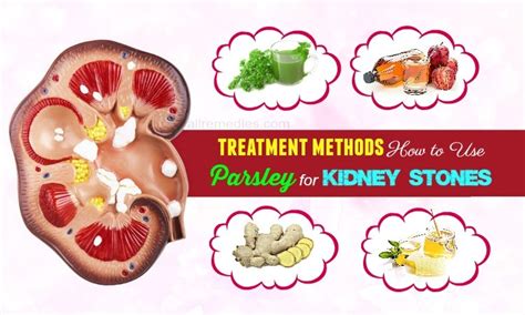 8 Treatment Methods How To Use Parsley For Kidney Stones Removal