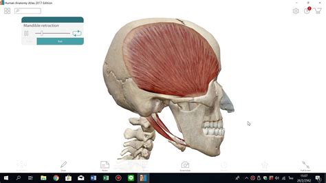 Mandible Retraction By Temporalis Muscle Youtube