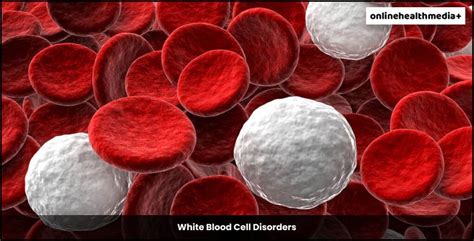 What Are Blood Cell Disorders Symptoms Treatment And Prevention