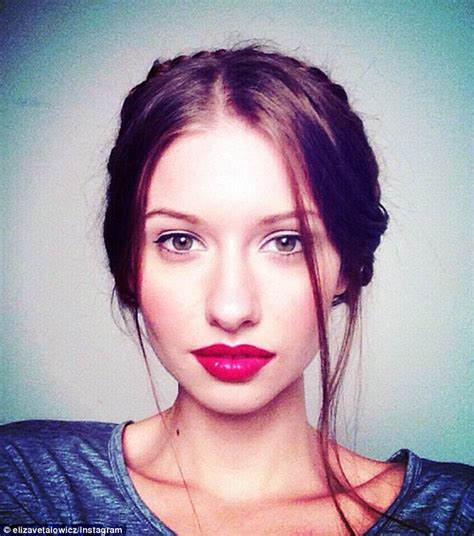 Elizaveta Bulokhova Who Lost 95 Of Her Jaw To Cancer Poses For