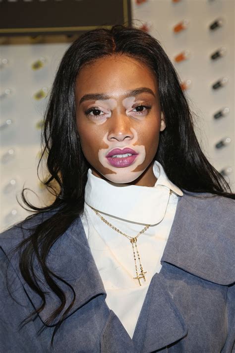 Winnie Harlow Is Starring In The New Swarovski Campaign