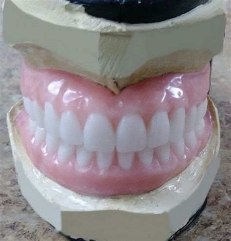 Upper And Lower Denture Custom Made Acrylic False Teeth Denture False