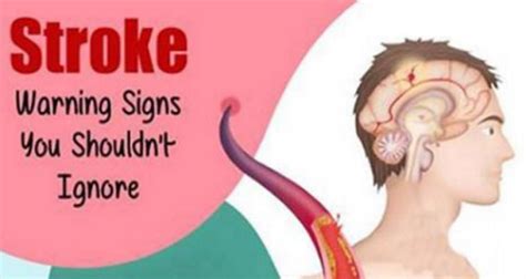 Warning Signs That Indicate Stroke Never Ignore Them