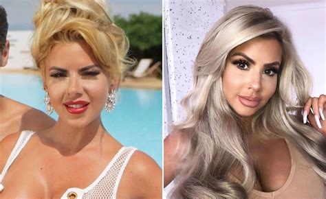 Hannah Elizabeth Before And After Love Island Star Reveals About Her Surgery Transformation