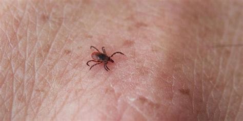 Where Ticks Bite Check Your Thigh First Upstate Survey Indicates