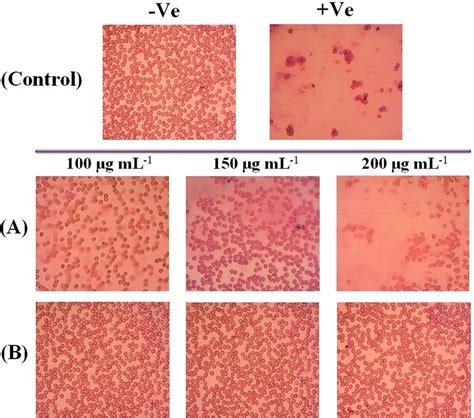 Light Microscopic Images Showing The Hemolytic Toxicity A Pure Tam