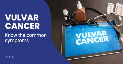 Vulvar Cancer Symptoms Treatments Diagnosis And More