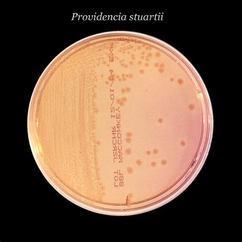 Lista 91 Foto Bacterias Que Crecen En Agar Macconkey El último
