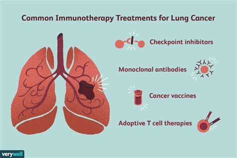 Immunotherapy For Lung Cancer How Successful Are Drugs