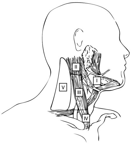 Level Designation For Cervical Lymphatics In The Right Neck Reprinted
