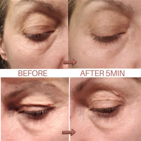Buy Best Instant Lifting Serum For Face Anti Wrinkle Eye Serum Online