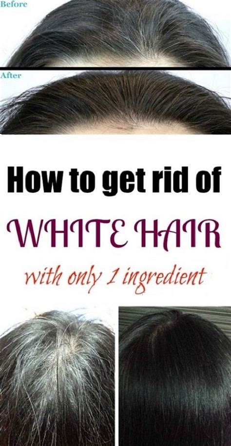 How To Get Rid Of White Hair Grey Hair Remedies Hair Cure Dyed