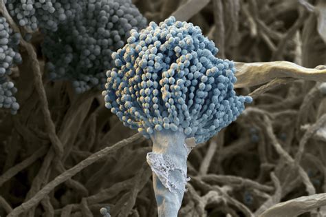 Aspergillus Humans Lungs With Fungi Close Up Aspergillus Vector Image