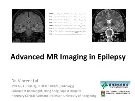 Neurology Advanced Mr Imaging In Epilepsy V Lai Ppt