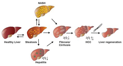 Overview Of Liver Diseases And Their Impact On Platelet Count
