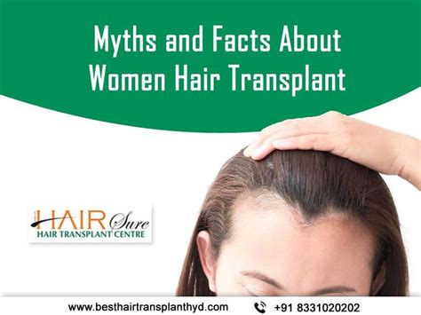 5 Myths And Facts About Womens Hair Transplants Cyber Hairsure