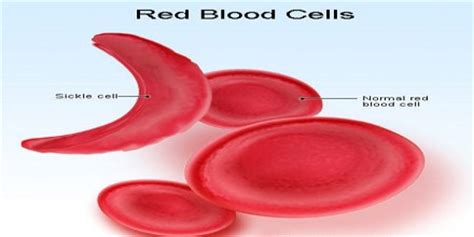 Red blood cell, cellular component of blood that carries oxygen from the lungs to the tissues and gives vertebrates' blood its characteristic color. Structure and Functions of Red Blood Cell - Assignment Point