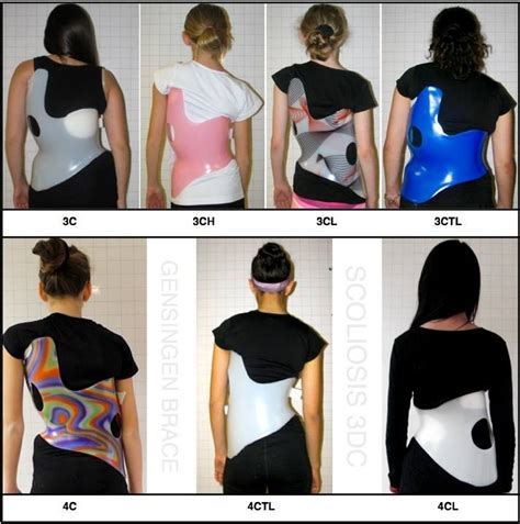 Scoliosis Is An Asymmetric Condition Best Treated With A Custom