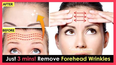 Just 3 Mins How To Remove Forehead Wrinkles Forehead Lines Naturally