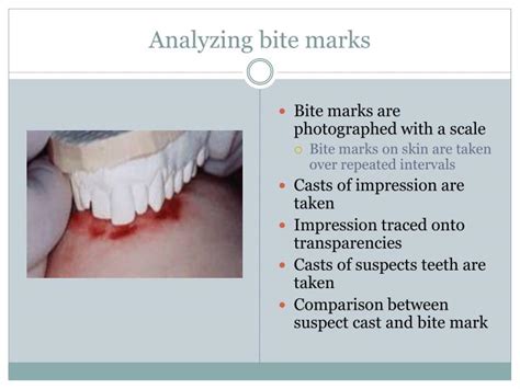 Ppt Forensic Odontology An Introduction To Forensic Dentistry Powerpoint Presentation Id720056