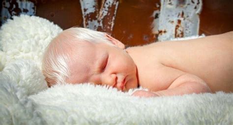 Baby Born With White Hair Is One Of The Rarest And Most Beautiful
