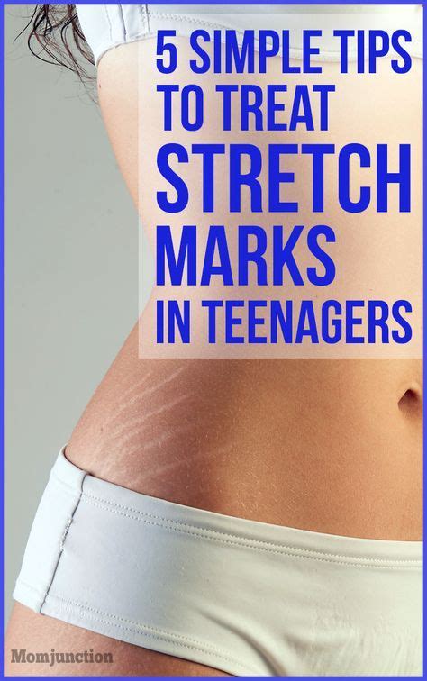 5 Simple Tips To Treat Stretch Marks In Teenagers Stretch Marks