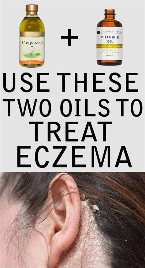 Eczema Scalp Vitamine Grapeseedoil Apply These Two Oils Available