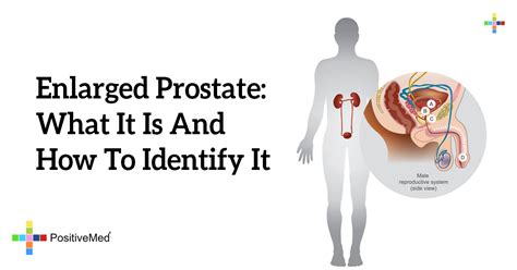 Enlarged Prostate What It Is And How To Identify It