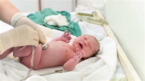 Leading Ob Group Now Recommends Delaying Umbilical Cord Clamping For