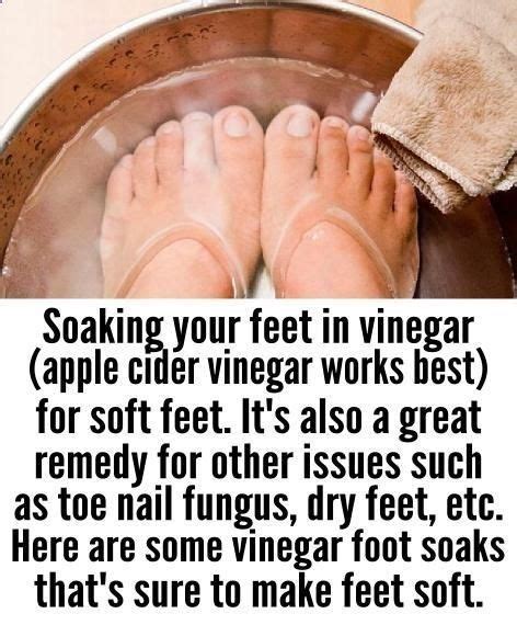Apple Cider Vinegar Foot Soak For Soft Feet Footsoakbakingsoda