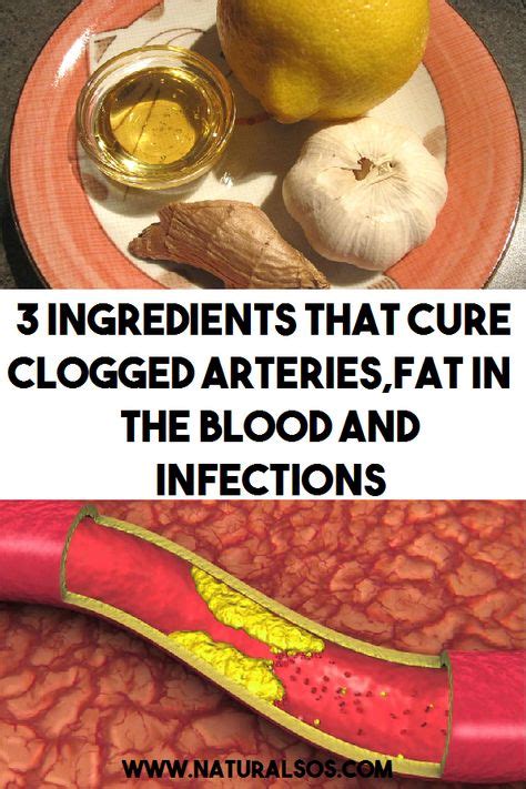 7 Best Clean Clogged Veins Images The Cure Remedies Health