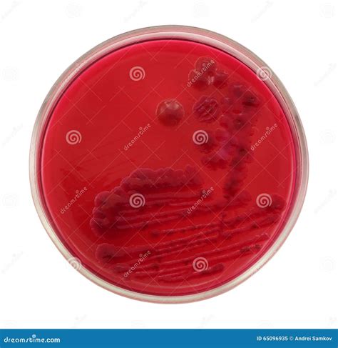 Colonies Of Escherichia Coli Bacteria On Red Agar Petri Plate Stock