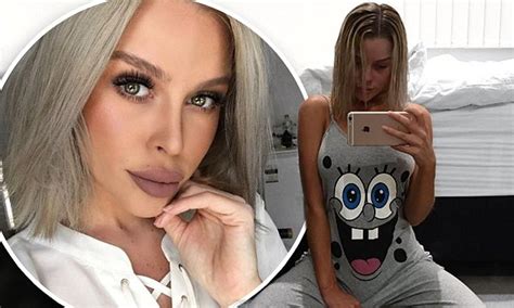 Skye Wheatley Hides Swollen Face On Instagram As She Recovers From Nose Job