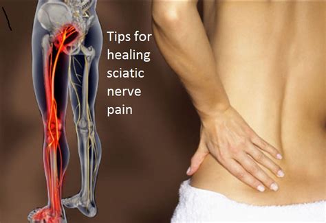 Tips For Healing Sciatic Nerve Pain According To Health Articles