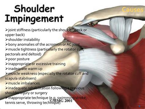 Shoulder Impingement Anatomy