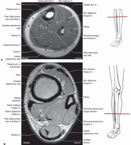 Foot Ankle And Calf Musculoskeletal Key